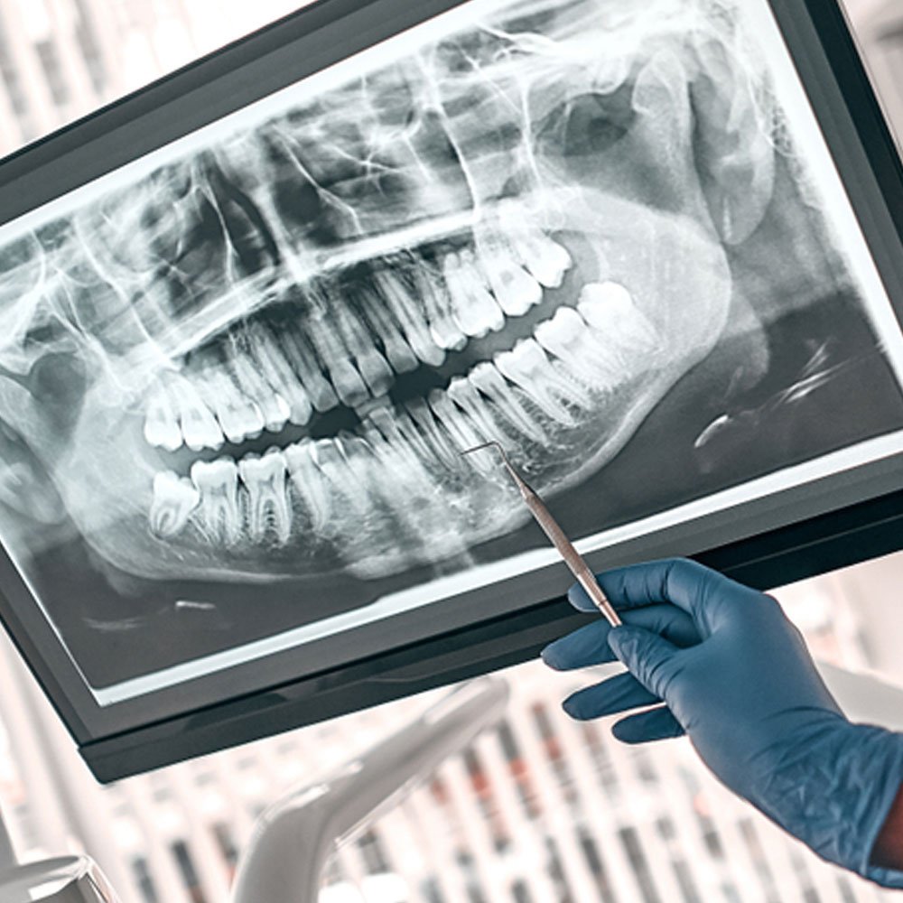 radiographie dentaire