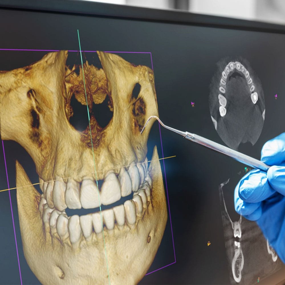 scanner 3d des dents agadir