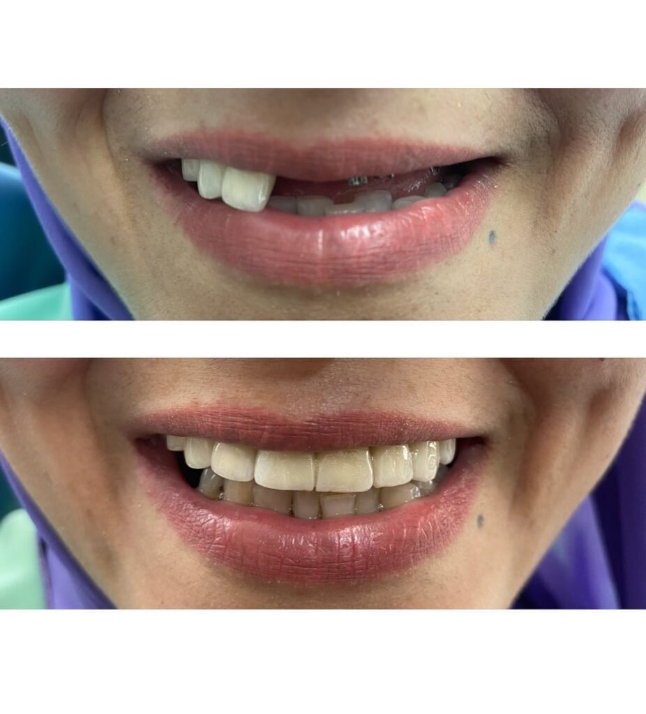 relooking sourire salé